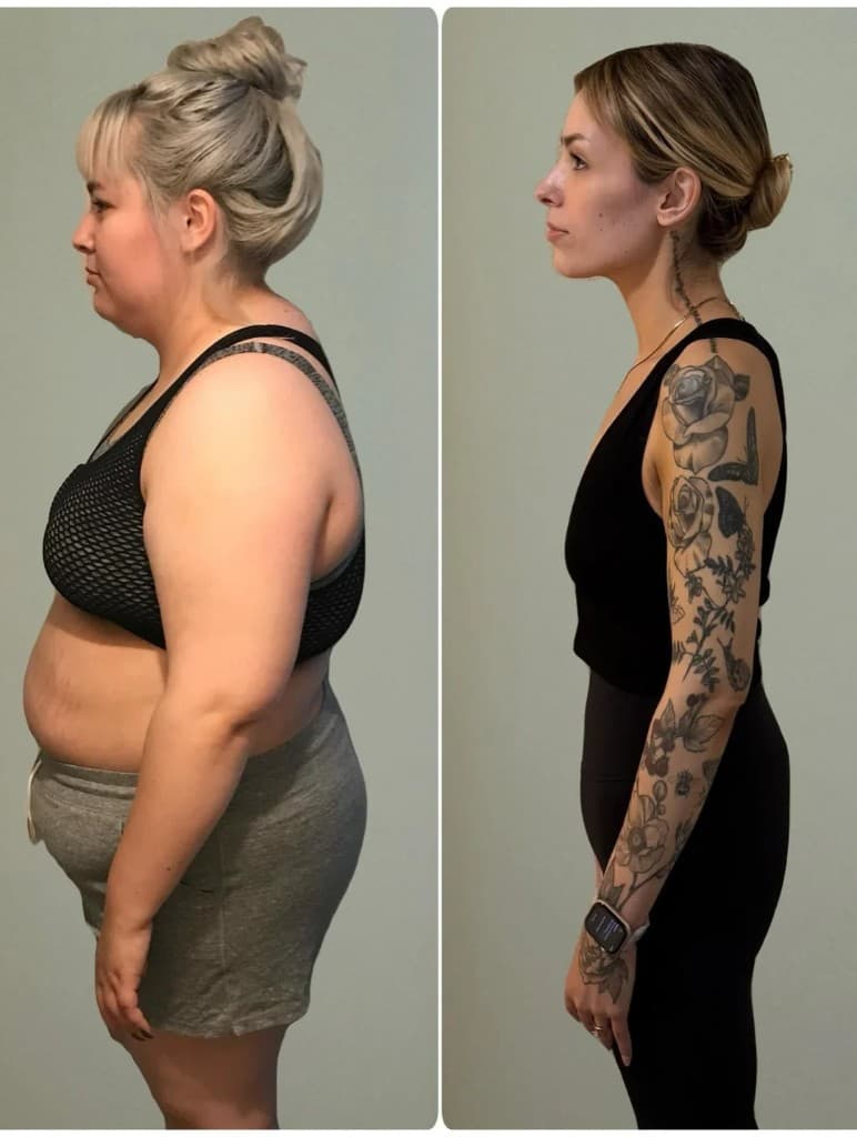 Before and after — Sophie R.